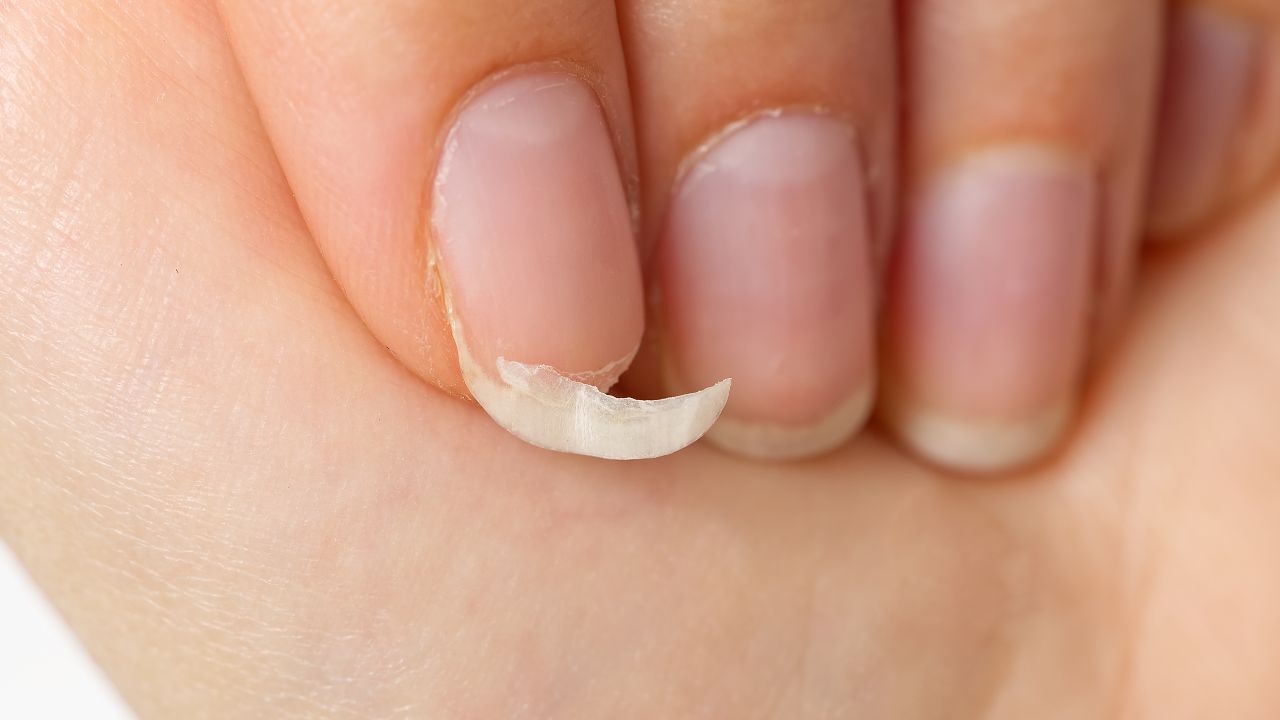 If someone has a problem with breaking nails or strange ridges, the body might be craving protein or iron. Protein is essential for nail strength, and iron helps carry oxygen to the nail beds. Low iron levels can leave the nails weak and pale. Time to load up on eggs, spinach, nuts, and lean meats! Brittle nails